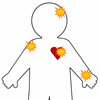 Pin the Band-Aid on the Injury